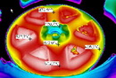 Flir Thermography